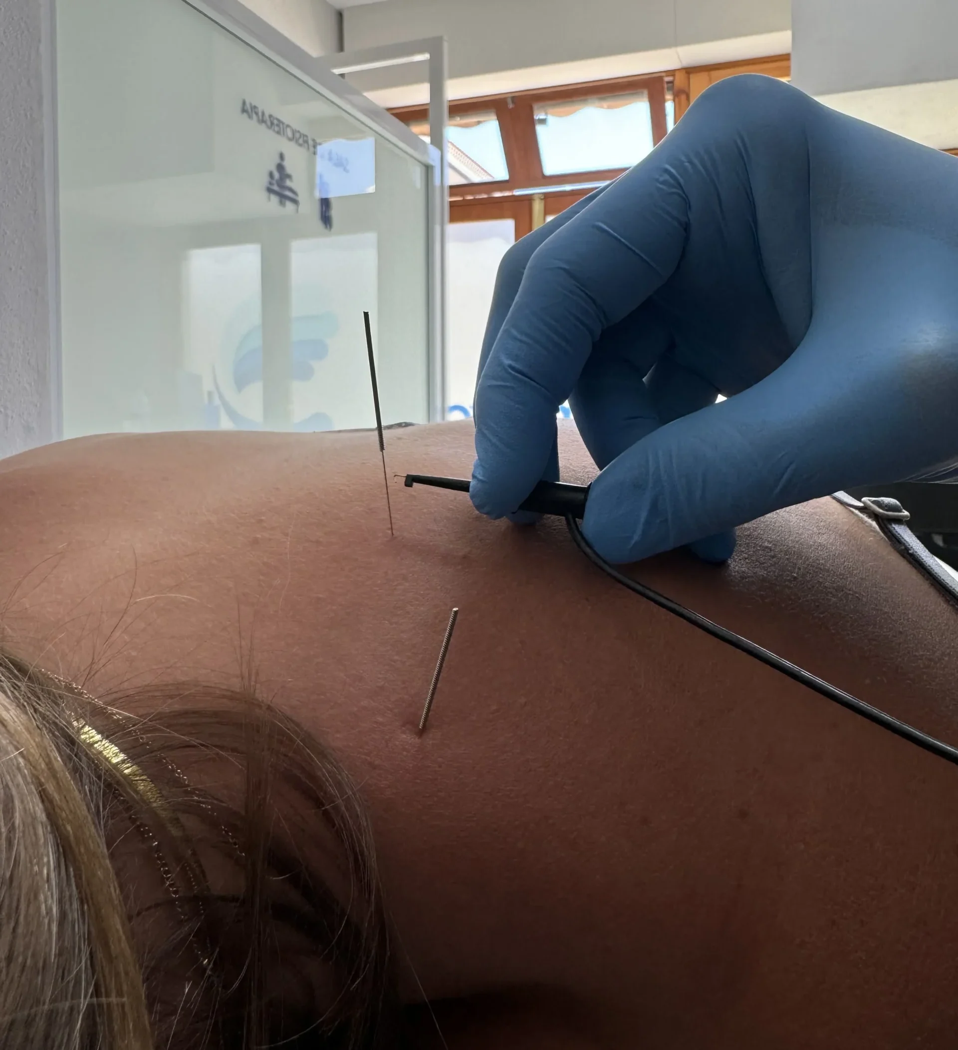 Neuromodulación en el puerto de la cruz